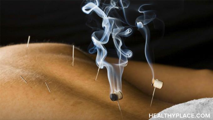 Acopera tratamente alternative de dependenta, cum ar fi acupunctura, hipnoterapia si ibogaina pentru a trata dependenta.